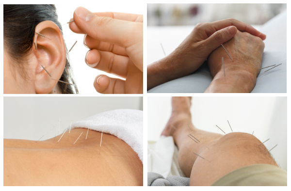 City Øst Zoneterapi Akupunktur